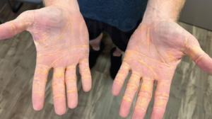 Ірімшік пен майды шамадан тыс тұтыну денсаулыққа қауіпті