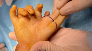 Балалардың толыққанды өмір сүруіне мүмкіндік сыйлады