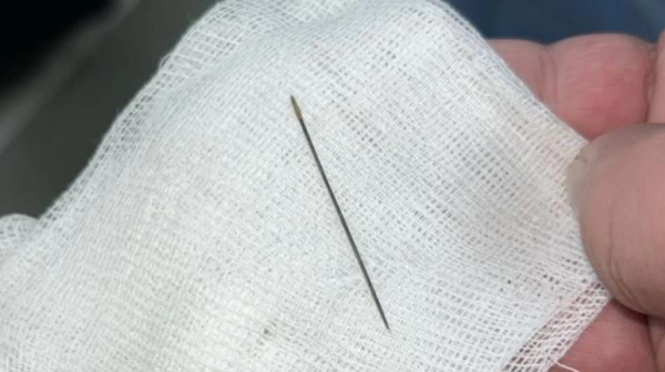 8 aılyq balanyń ishki qurylysynan ıne tabyldy