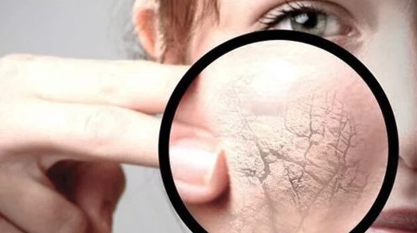 Қыста неліктен теріге ерекше күтім қажет?