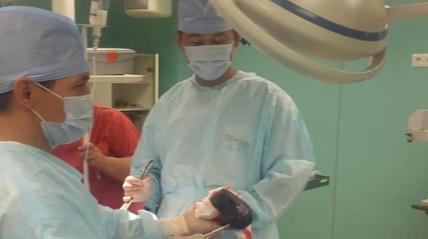 Пациенттің асқазанында бірнеше жыл бойы шаштан түзілген түйін болған - №4 қалалық клиникалық ауруханада күрделі ота жасалды