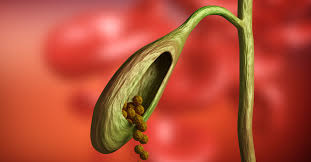 Өтің ауырмасын десең...